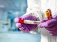 Сотні нових заражень і смерті: МОЗ оприлюднило тривожні дані по коронавірусу на 13 травня