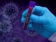 Епідемія не відступає: В Україні коронавірус вбив за добу 25 осіб