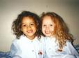 З архіву ПУ. Іноді природа жартує: У мережі показали, як зараз виглядають сестри-близнючки, які народилися з різним кольором шкіри (фото)