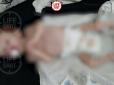 У Росії горе-мати ховала немовля у шафі: Виснажену дитину випадково знайшла гостя (фото)