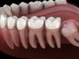 Зникають зуби мудрості, з'являється додаткова артерія і не тільки: Вчені виявили нову стадію еволюції людини