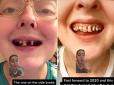Дівчина показала в TikTok, що буде з зубами, якщо пити колу кожен день (фото, відео)