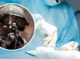 Куля ворожого снайпера прошила голову навиліт: Лікар розповів про дивовижний порятунок воїна ЗСУ