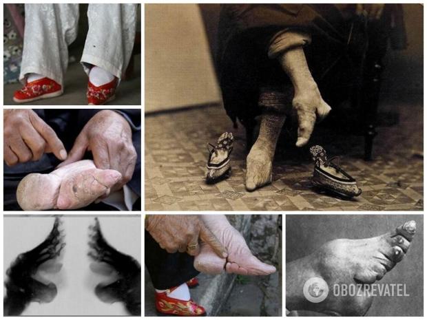 5-річним дівчаткам у стародавньому Китаї туго бинтували стопи, щоб нога не збільшувалася в розмірі