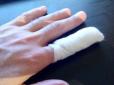 Зламали палець: У Києві поліцейські жорстко затримали ветерана АТО (відео)