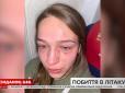 Розбита голова та закривавлене обличчя: У літаку з Туреччини побилися дві українки (відео)
