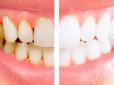 Усе не так просто, як ми гадали: Стоматолог розповів, чому не можна чистити зуби відразу після їжі