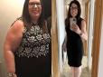 Британка схудла на 68 кг після того, як зганьбилася на прийомі у лікаря