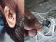 Вбито телефонним дзвінком: В Індії навушники вибухнули прямо у вусі чоловіка