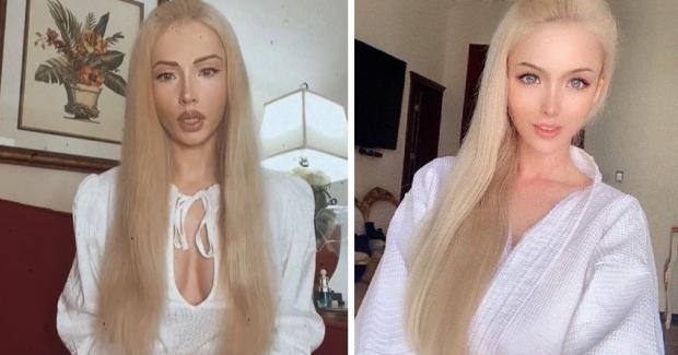 Одеська Барбі різко здала і постаріла: фото 36-річної Валерії Лук'янової до і після