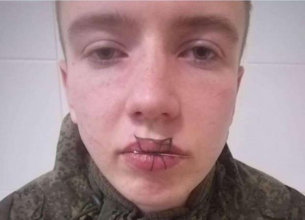 На Росії солдат зашив собі рот…