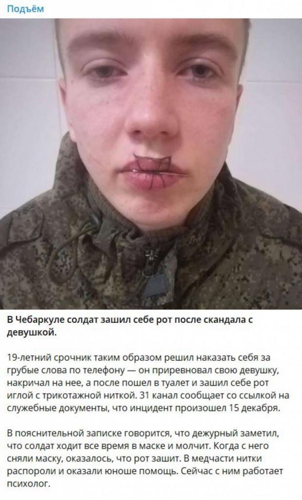 Російський солдат зашив собі рот
