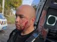 Неадекватів досвід інших не вчить: На Дніпропетровщині чоловік із ножем напав на поліцейських, ті вистрілили