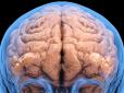 Не плутати з подоланням похмілля: Науковці дізналися, скільки часу потрібно мозку, щоб відновитися після відмови від вживання алкоголю