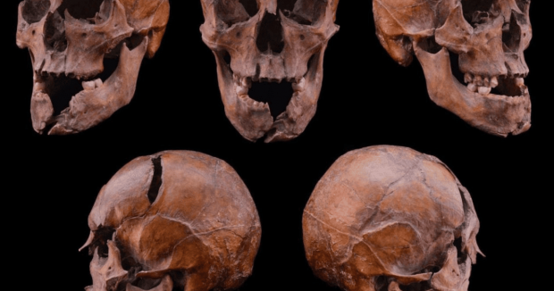 Череп сина галицького князя Ростислава