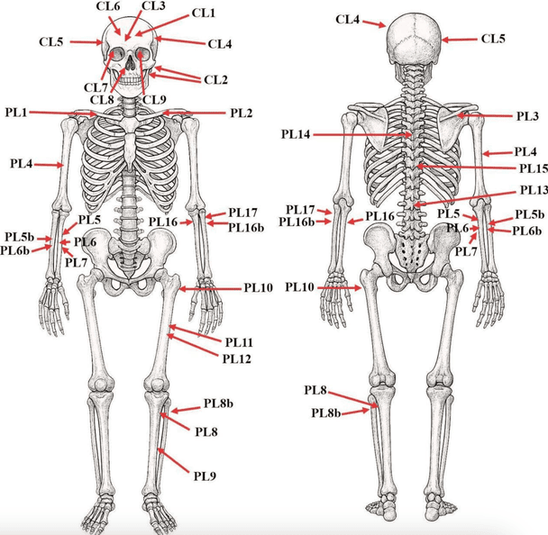 Схема пошкоджень на кістках Бели Ростиславовича. / © Фото з відкритих джерел