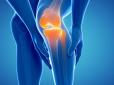 Варто знати! Через що восени та взимку загострюються проблеми суглобів