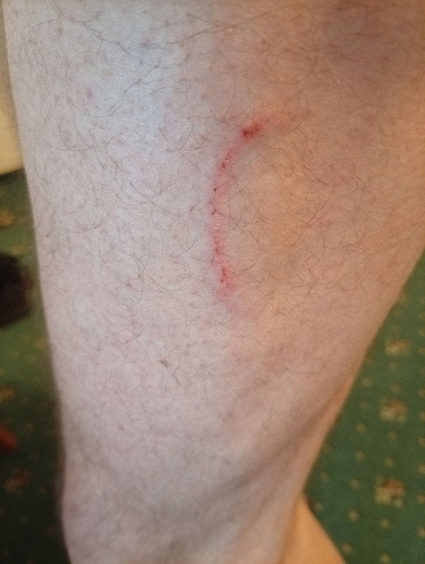 Фото укусу собаки