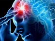 Не пропустіть! Названо симптоми інсульту, які можна помітити за тиждень до удару